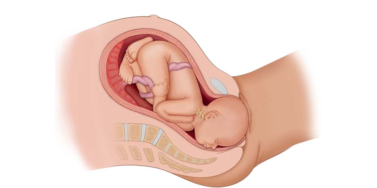 分娩对盆底肌肉的影响你了解多少？为什么医生要求你在产后42天做检查？